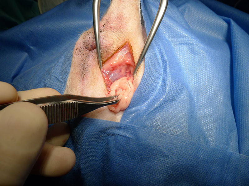 Photo de chirurgie des tissus mous